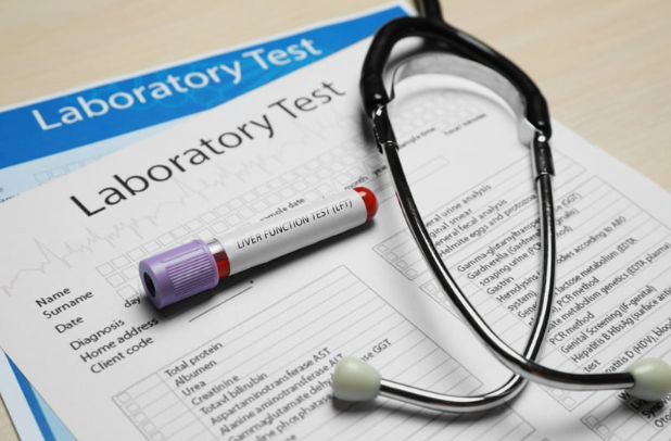 Laboratory analysis equipment